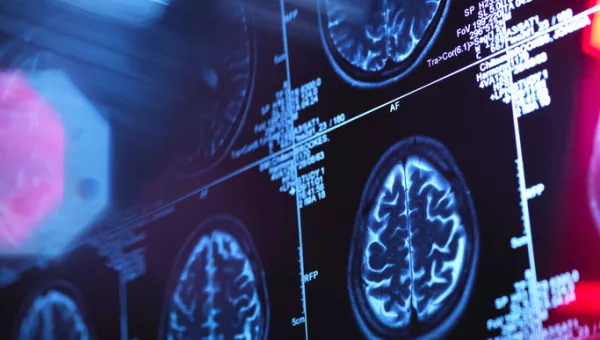 medical scans of a human brain