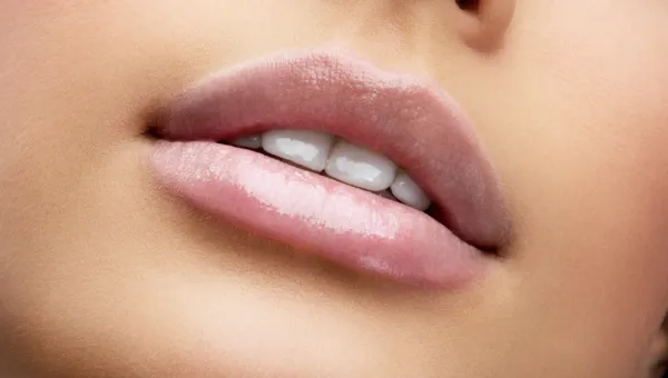 lip filler