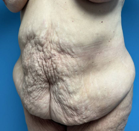 body2